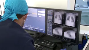 Platformă unică în România pentru pacienţii cu boli pulmonare