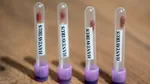 Focarul de hantavirus se extinde: Spania anchetează un caz suspect legat de nava MV Hondius