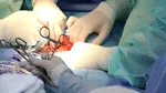Patru prelevări de organe și 12 transplanturi făcute în ultimele două zile