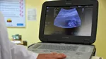 Focar de tuberculoză într-un mare oraș al Italiei în care trăiesc zeci de mii de români. 15 persoane, depistate pozitiv