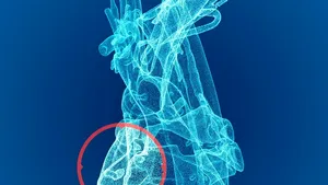 Tehnologia 3D poate salva mii de vieţi. HeartFlow ajută pacienţii să fie diagnosticaţi şi trataţi de cinci ori mai rapid