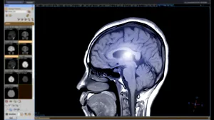 Copiii învaţă despre accidentul vascular cerebral, pentru a-şi salva bunicii. Trei simptome care pot prevesti un AVC