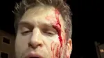 Keegan Allen, actorul din „Pretty Little Liars”, jefuit sub amenințarea armelor la Los Angeles. A fost lovit cu un pistol pentru ceasul său