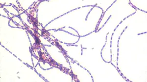 Armele biologice ale Rusiei. În ultimii 40 ani s-au înregistrat cinci accidente grave în care au fost eliberaţi viruşi periculoşi