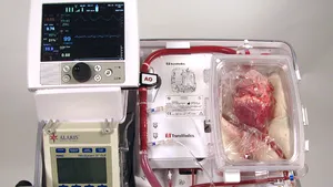 PREMIERĂ în Europa: Primul transplant al unei inimi care a încetat să bată în corpul donatorului a fost realizat cu succes