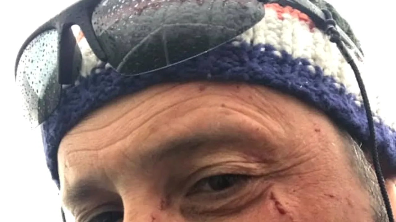 Atac fără avertisment. Bărbat lovit în Deltă, în faţa unui grup de turişti din Germania. Victima a suferit mai multe răni la nivelul feţei - VIDEO 