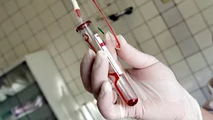 Terapia Dracula - injectarea propriului sânge în muşchii feţei