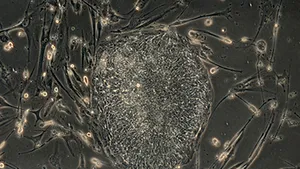 Romanian MedLife Starts Stem Cell Collection Operations