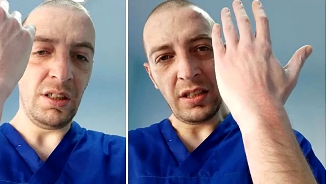 Un medic român şi-a arătat mâinile afectate de dezinfectant: 