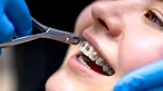 Cum îți influențează sănătatea generală o dantură perfect aliniată (P)