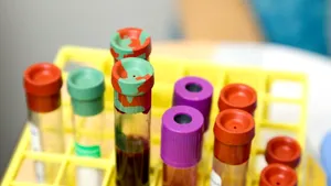 Aproape o treime din angajații în sănătate din Europa se confruntă cu risc de cancer la locul de muncă