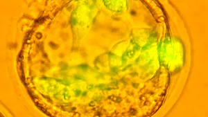 O nouă metodă de distrugere a celulelor canceroase, descoperită de cercetători