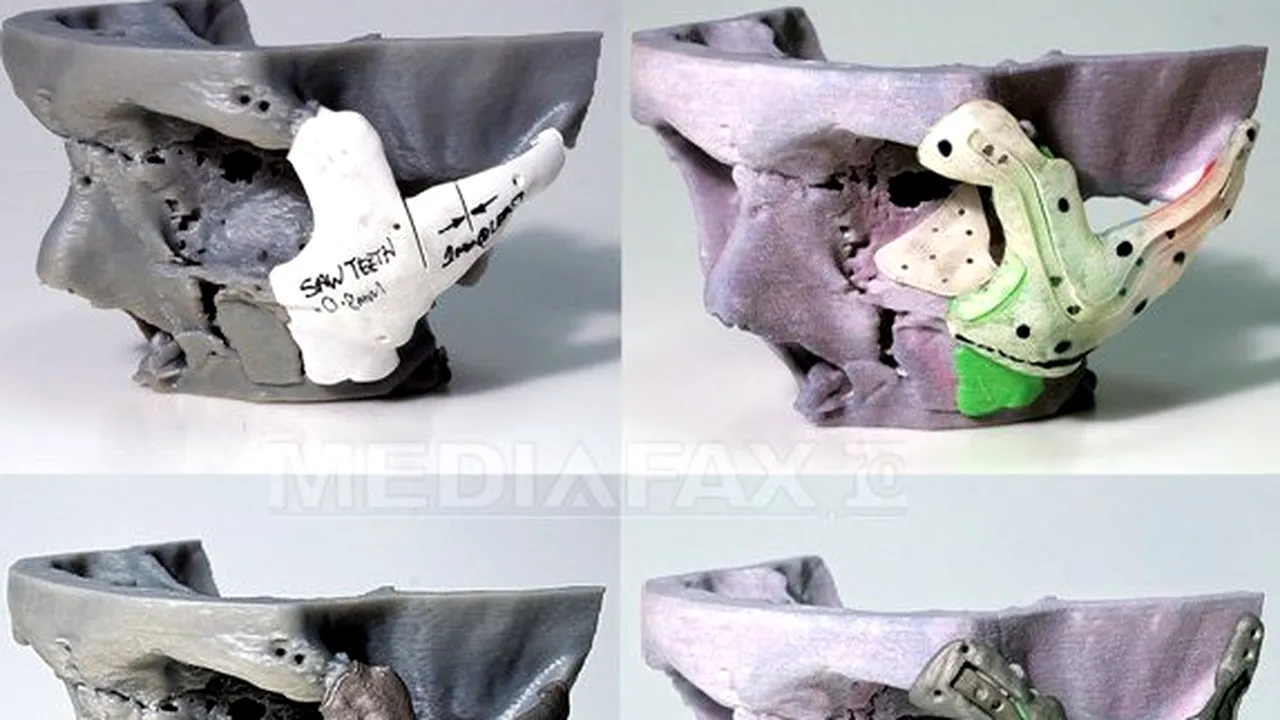 Reconstrucţia facială: Rezultate incomparabile, graţie imprimantelor 3D - FOTO