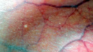 De ce sunt venele albastre