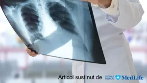 Recuperarea după COVID, esenţială pentru a evita sechelele pulmonare. De ce e importantă monitorizarea pacienţilor după vindecare