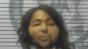 Jaf în SUA pentru bani de operaţii estetice. Ce pedeapsă riscă autorul