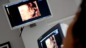 Procedură în premieră. O tumoră care apăsa inima și plămânii unui făt, micșorată fără operație