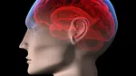 Inteligența artificială prezice reapariția tumorilor cerebrale la copii cu precizie impresionantă