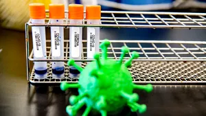 COVID-19 în lume. Specialiştii avertizează: ce e mai rău urmează