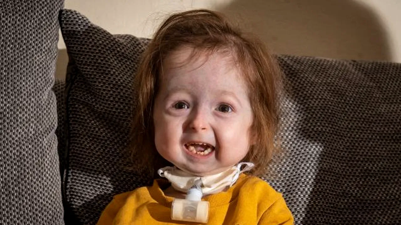 Fetiţă de doi ani, singurul pacient din lume cu varianta unei boli prezentate în filmul „Benjamin Button”