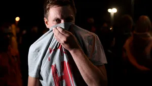 Belarus: acuzaţii de „tortură pe scară largă” la care poliţia a supus protestatarii deţinuţi