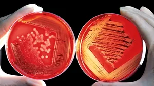 Descoperire uriașă. Unele bacterii pot supraviețui în spațiu și răspândi viața între planete