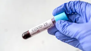 Primul test care îţi arată cât de imun eşti la coronavirus a fost creat în Franţa