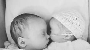 Naştere super-gemeni. O femeie a rămas însărcinată în timp ce era însărcinată