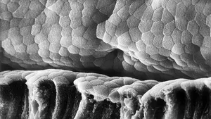 Bacteriile intestinale influenţează severitatea bolii COVID-19 . Ce spun studiile