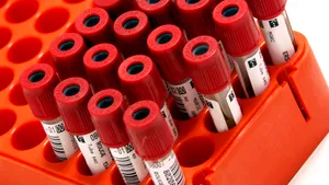 Speranţă în lupta împotriva cancerului ovarian: Primul vaccin din lume, în dezvoltare la Oxford