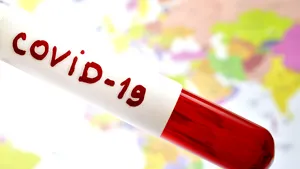 De ce are Rusia mai puţine cazuri de infectare cu coronavirus decât ţări ca Luxemburg