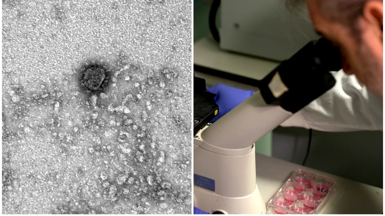  Ruşii susţin că au capturat prima imagine la microscop cu noul coronavirus şi i-au decodat genomul. Asta ar ajuta la găsirea unui vaccin. FOTO