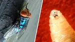 Parazit carnivor mortal, descoperit pentru prima dată la o persoană în SUA