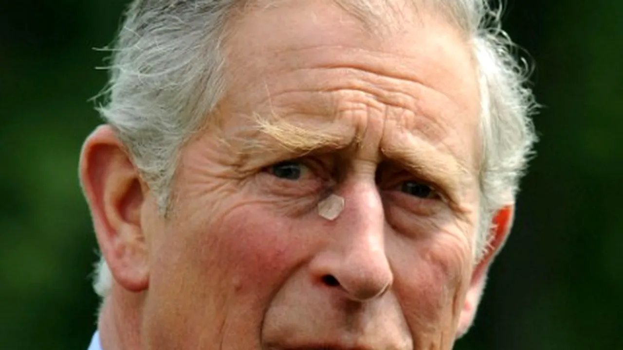 Prinţul Charles a suferit o intervenţie chirurgicală minoră