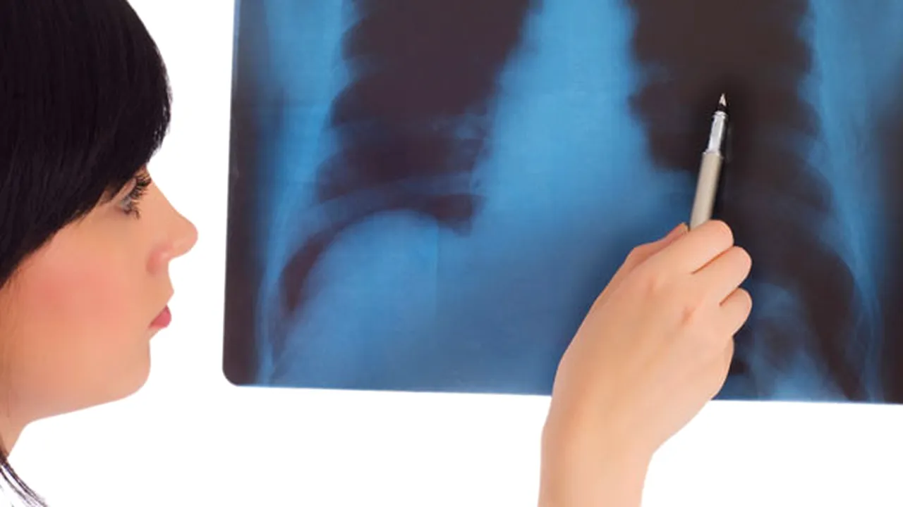 Aparat unic în vestul României, la Timişoara. Măsoară rezistenţa pulmonară pe căile respiratorii