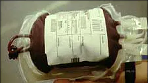 Sângele pentru transfuzii stocat peste 35 de zile favorizează infecţiile