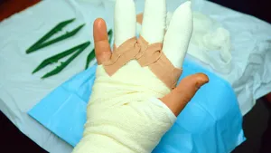 La cinci ani de la Colectiv, România are în continuare probleme cu marii arşi. Clinica de la Iaşi a trimis o femeie la Bucureşti, pentru că nu mai are locuri 