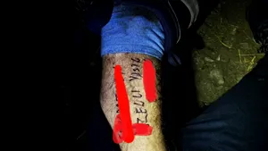 Un turist abandonat de prieteni pe munte şi-a scris CNP-ul şi numele pe picior, convins că va muri