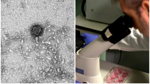  Ruşii susţin că au capturat prima imagine la microscop cu noul coronavirus şi i-au decodat genomul. Asta ar ajuta la găsirea unui vaccin. FOTO