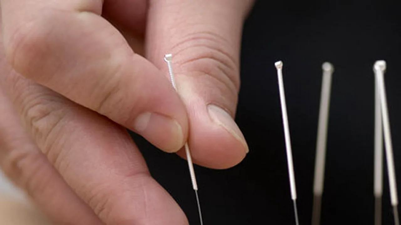 Acupunctura tratează fobia de stomatolog