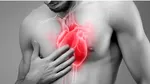 Strategia Naţională pentru Combaterea Bolilor Cardiovasculare şi Cerebrovasculare, aprobată
