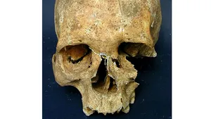 Găuri în cap de la buzdugane şi topoare: Cum supravieţuiau soldaţii medievali?