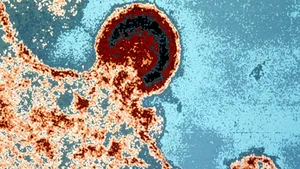 SIDA: un vaccin experimental redă speranţă cercetătorilor