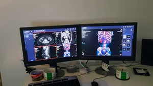 Intervenţie de fixare de bazin cu machetă personalizată 3D, la SCJU Târgu Mureş