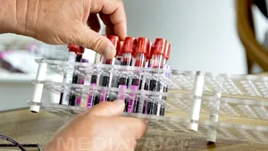 Persoanele care au nevoie urgentă de sânge pot utiliza o platformă dedicată donării benevole