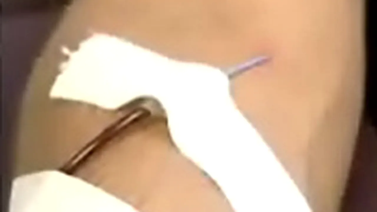 Colegiul Medicilor Sibiu va fi sesizat în legătură cu o transfuzie de sânge greşită