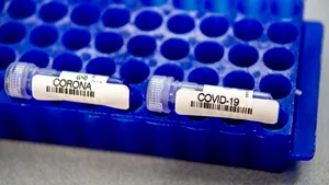 Coronavirus Japonia: A fost creat testul care depistează virusul în doar două ore