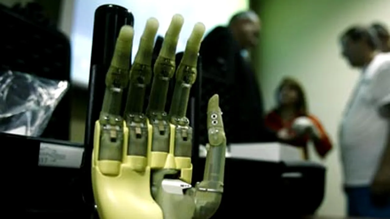 Primul român care foloseşte mâna bionică este student la drept