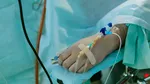 Studiu. Folosirea inteligenței artificiale în colonoscopii riscă să submineze competențele medicilor