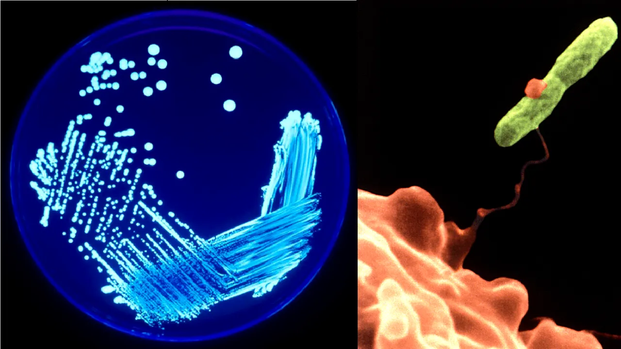 O bacterie periculoasă ar putea deveni aliatul medicilor în lupta cu cancerul intestinal